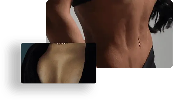 Imagem de resultado de cirurgia plástica