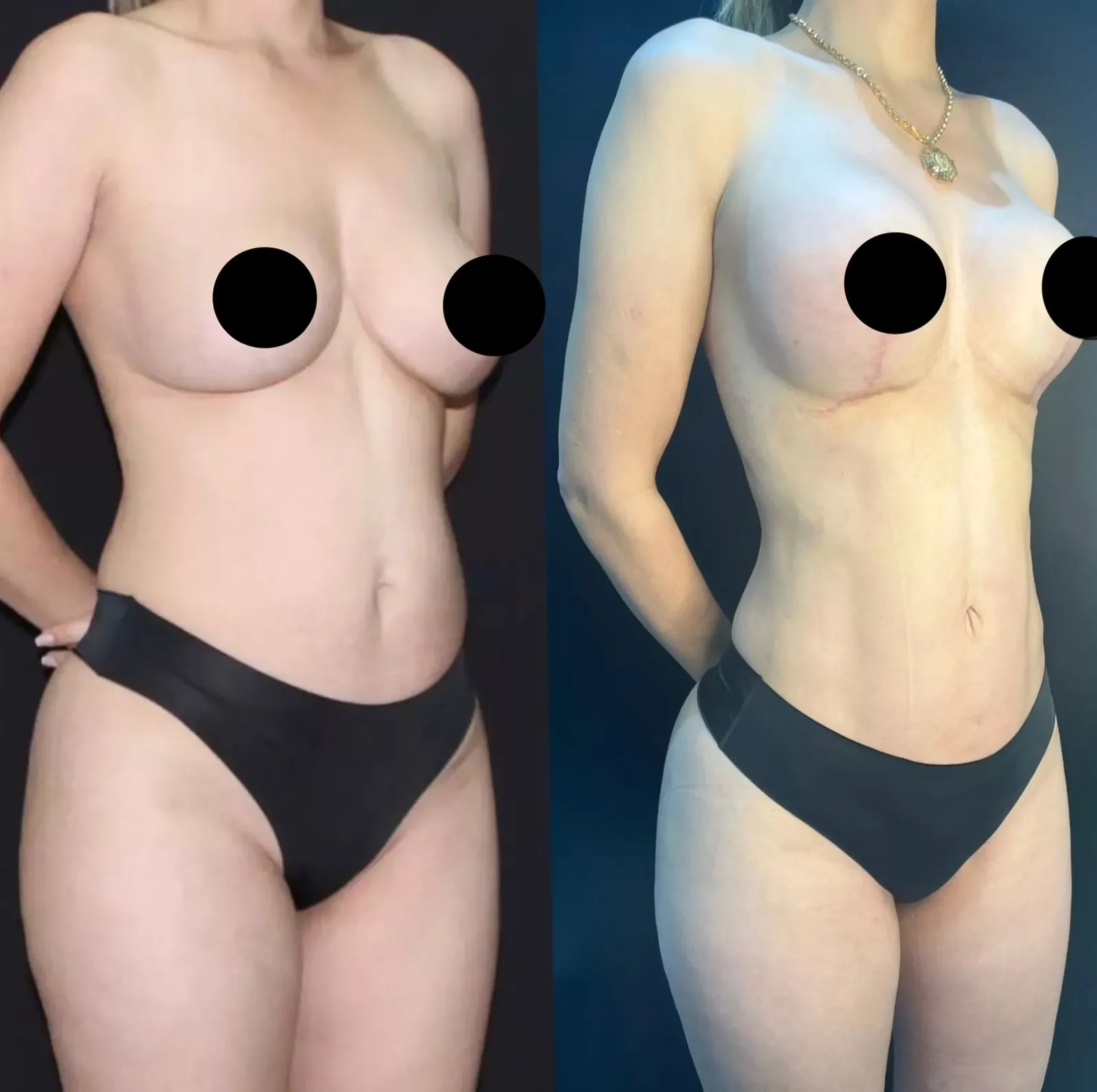 Contato via WhatsApp