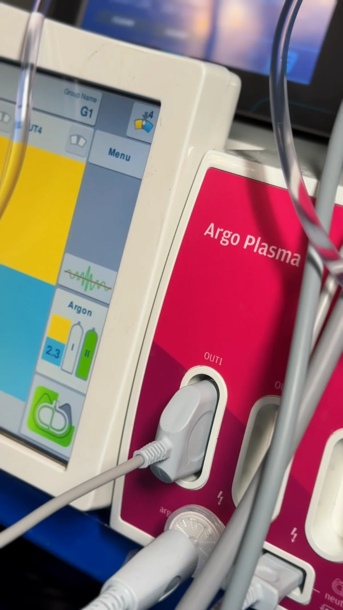 Equipamento de Argoplasma em sala cirúrgica