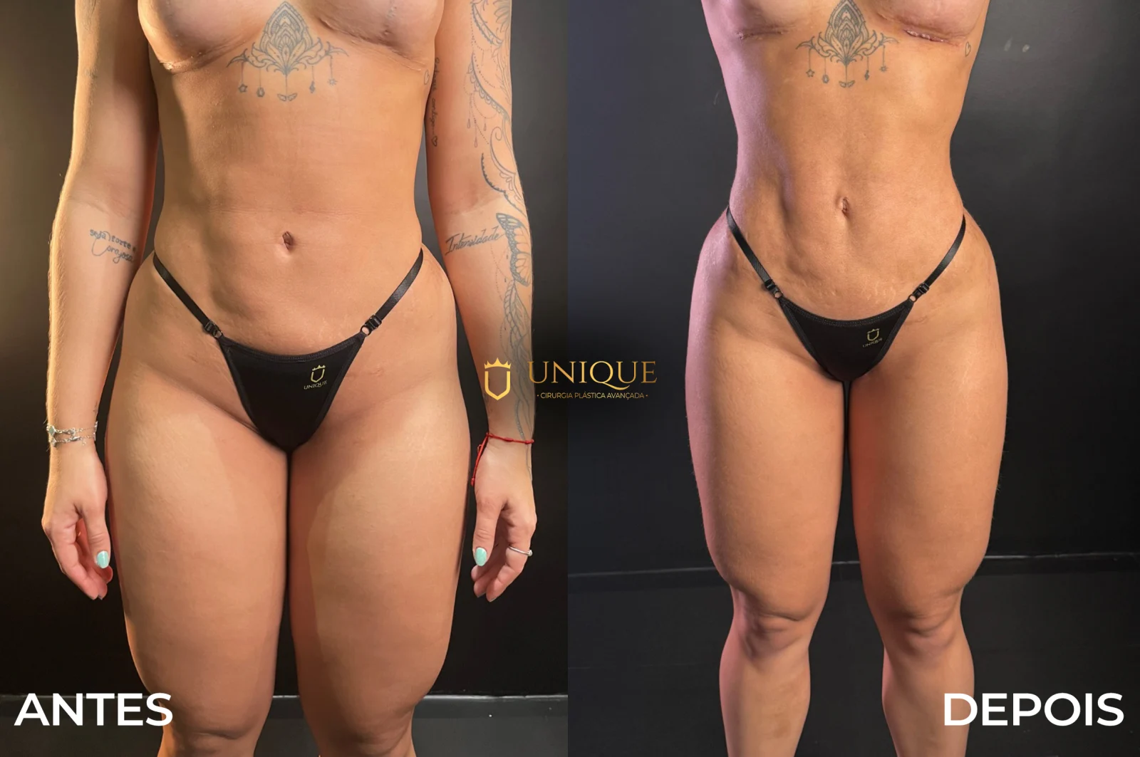 Antes e depois de paciente da Unique