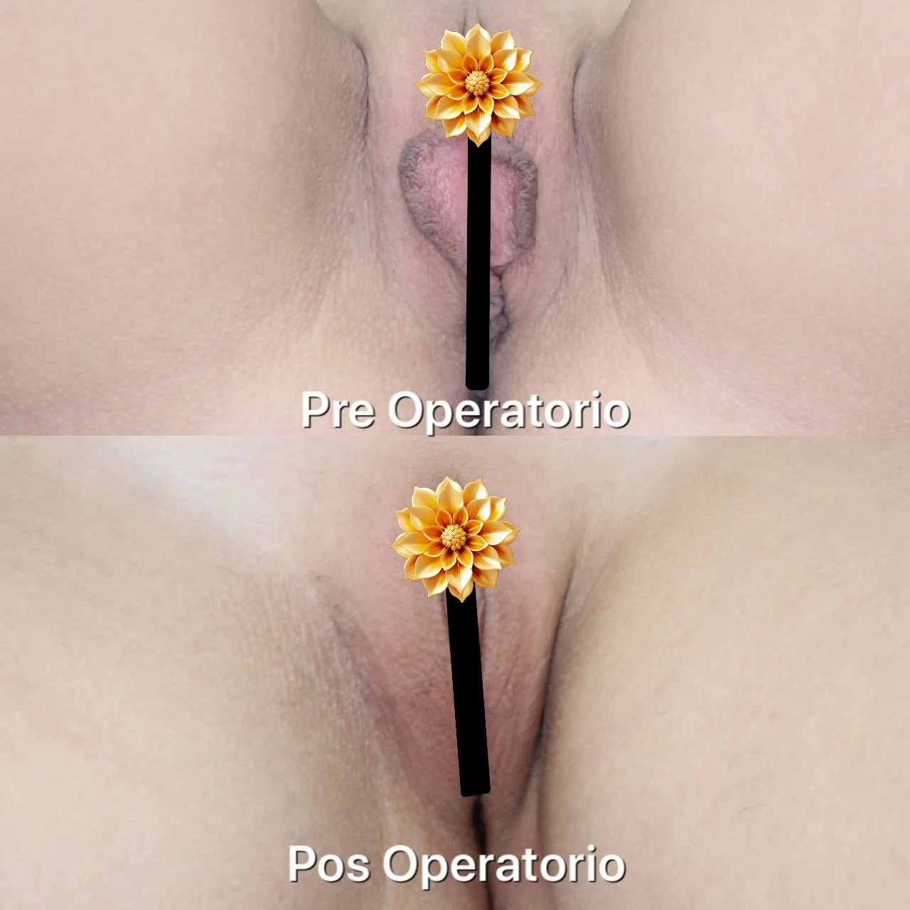 Registro clínico (borrado)