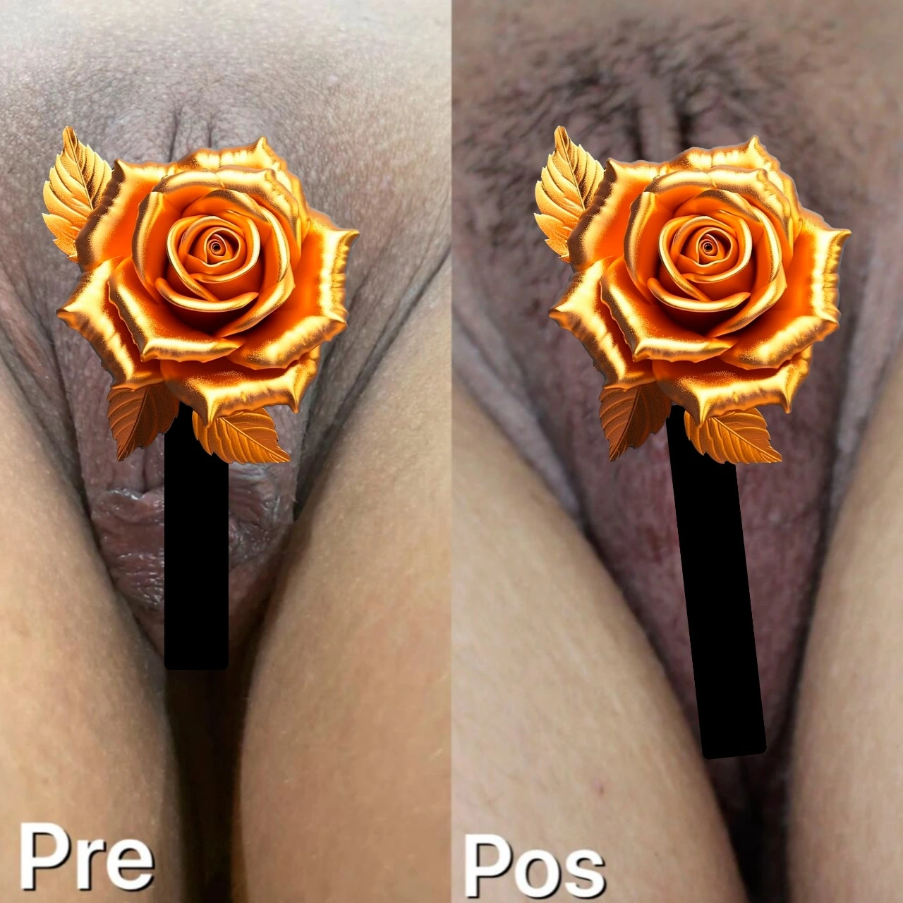 Registro clínico (borrado)